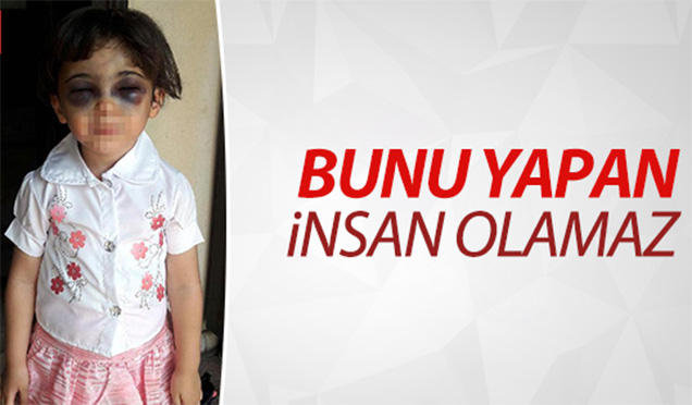 3 YAŞINDAKİ KIZINI DÖVEN ÜVEY ANNE TUTUKLANDI!