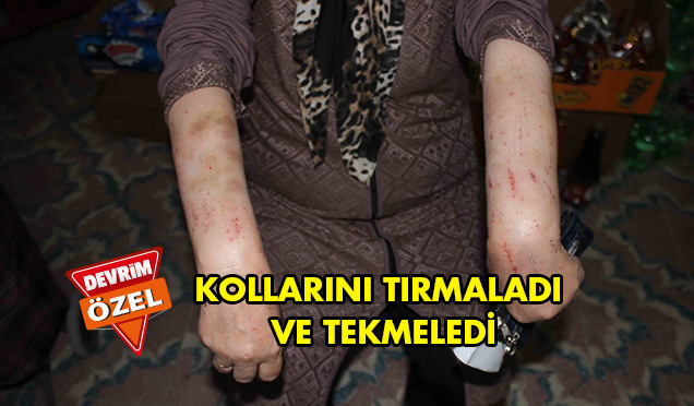 Yaşlı Kadın Saldırıya Uğradı