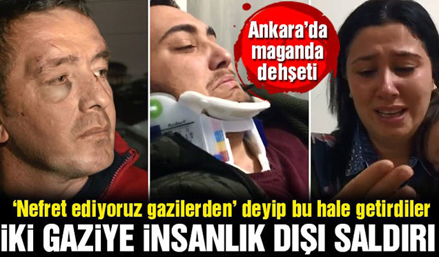 Başkent’te maganda dehşeti! Gazileri hastanelik ettiler