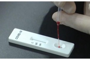 Çin Ankara Büyükelçiliği duyurdu! Corona’yı 15 dakika bulan test