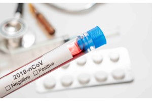 Korona Virüs Salgını Havayolu Sektörünü Olumsuz Etkiledi