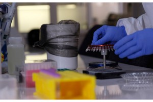 Bağışıklık sisteminin gücünü test etmek mümkün mü?