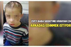 Üvey babasının işkencesi nedeniyle korumaya alınan çocuk: Arkadaş edinmek istiyorum