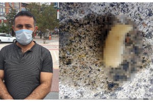 Fabrika işçisi: Yediğim yemekten insan parmağı çıktı