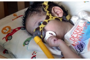 SMA hastası bebekler tedavi için yardım bekliyor