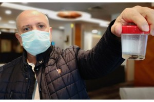 Kanser sandılar, biyopsi bile yapıldı;akciğerinden 32 yıl sonra çam fıstığı çıktı