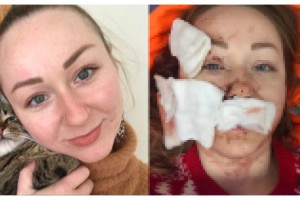 Ukraynalı kadına falçatalı saldırı yapan kocası tutuklandı