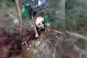 Tekirdağ'da piknik alanında bulunan kafatası ve kemiklere inceleme