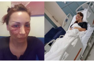 Bulgar modelin estetik kabusu; kuaför kardeşler: Örümcek ağı yapmadık, iftira