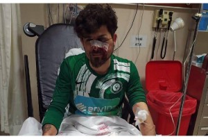 Kırmızı kart gören futbolcu, yerde yatan rakibinin yüzüne tekme atıp yaraladı