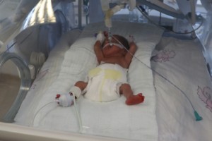 Kartal bebeğe kök hücre nakli yapıldı