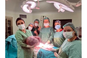 Karın şişliği için gitti, vücudundan 20 kiloluk kitle çıkarıldı