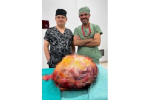 Karın ağrısı şikayetiyle gittiği hastanede karnından 26 kiloluk tümör çıktı